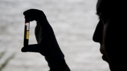 Crean nueva prueba de detección precoz de cáncer de páncreas