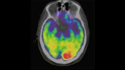 La música causa en el cerebro el mismo placer que el sexo