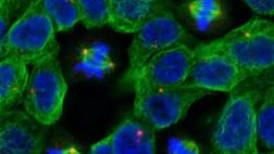 El cáncer secuestra células sanas para propagarse por el cuerpo