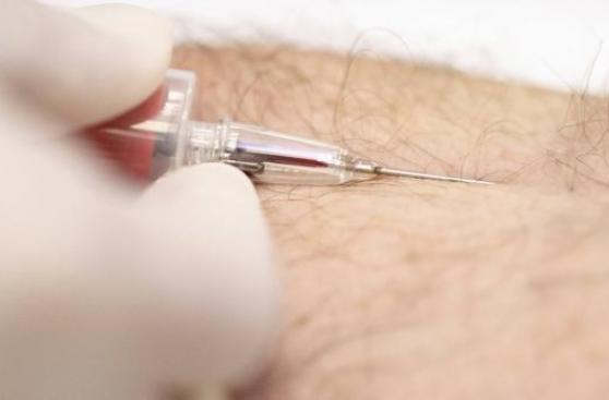 Cuba ensaya una vacuna para mejorar vida de pacientes con sida