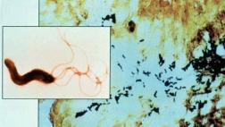 La OMS publica lista de las superbacterias más peligrosas