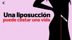 Liposucción: el camino de la belleza que puede costar una vida