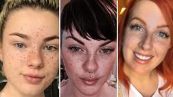 Instagram: las pecas están de moda en las redes sociales