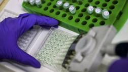 La supresión de proteínas podría curar ciertos tipos de cáncer