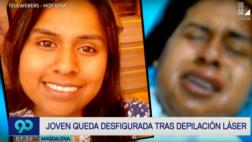 Magdalena: una joven quedó desfigurada tras depilación láser
