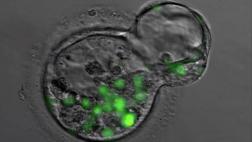 Medio ambiente, herencia y azar se combinan en el cáncer
