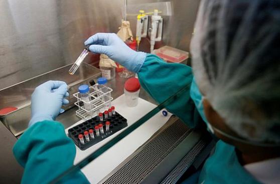 Prueba sanguínea logra diagnosticar tuberculosis en pocas horas