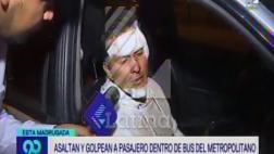Metropolitano: Pro Transporte cubrirá gastos de usuario atacado