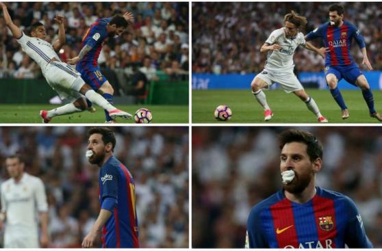 Lionel Messi jugó con algodón en la boca por unos minutos