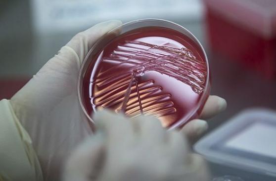 Las bacterias también aprenden a base de estímulos
