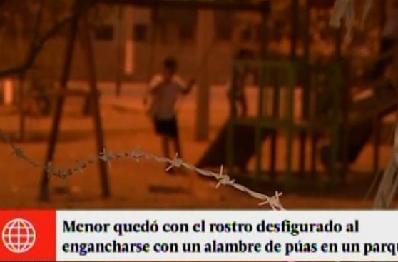 VES: niña sufrió cortes al caer sobre alambre de púas en parque