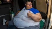 El hombre más obeso del mundo está listo para ser operado