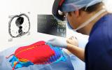 Realidad aumentada permite a médicos tener "visión de rayos X"